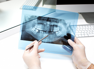 intraoral cameras image