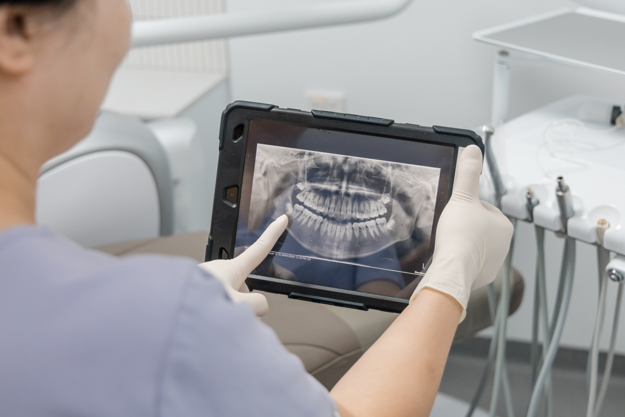 T32 Dental Wantirna professional reviewing a digital panoramic dental X-ray on a tablet.