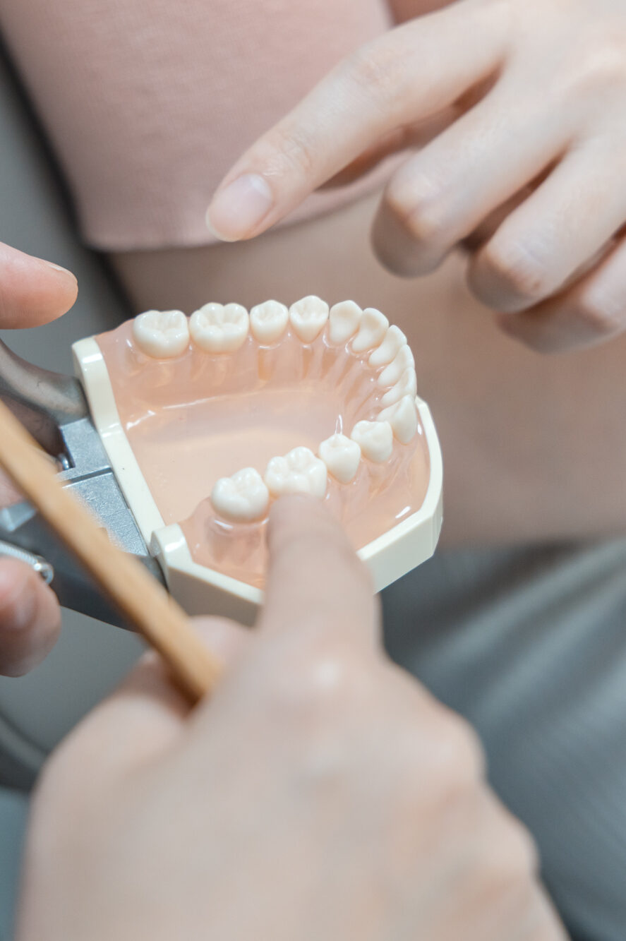 Dentist using a tooth model to explain the placement and fit of a porcelain veneer.