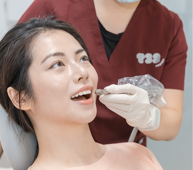 A dentist prepares a patient's front teeth for composite veneers during a cosmetic dentistry procedure.